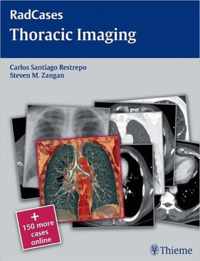 Radcases Thoracic Imaging