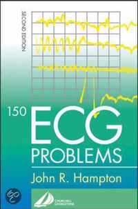 150 ECG Problems