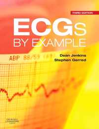 ECGs by Example