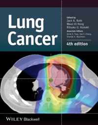 Lung Cancer