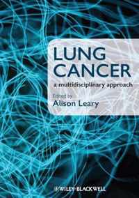 Lung Cancer A Multidisciplinary Approach