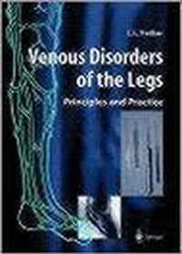 Venous Disorders of the Legs