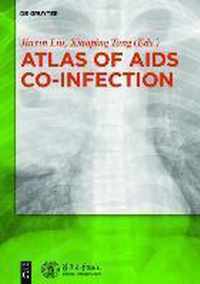 Atlas of AIDS Co-infection