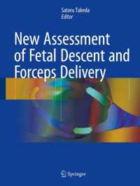 New Assessment of Fetal Descent and Forceps Delivery