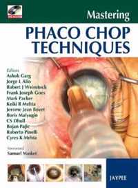 Mastering Phaco Chop Techniques