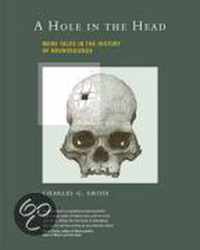 A Hole in the Head