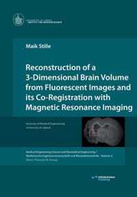 Reconstruction of a 3-Dimensional Brain Volume from Fluorescent Images and its Co-Registration with Magnetic Resonance Imaging