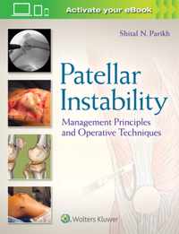 Patellar Instability