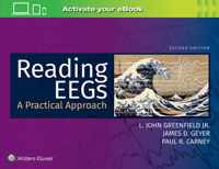 Reading EEGs