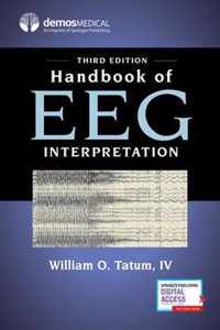 Handbook of EEG Interpretation