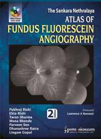 Atlas of Fundus Fluorescein Angiography