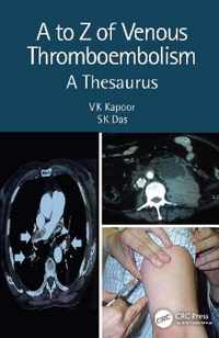 A to Z of Venous Thromboembolism