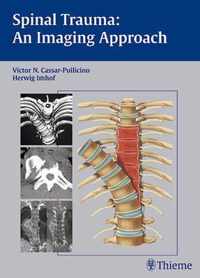 Spinal Trauma - An Imaging Approach