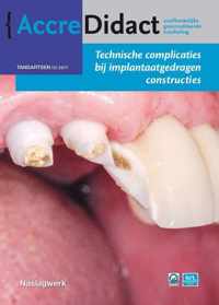 AccreDidact TA2017-2 -   Technische complicaties bij implantaatgedragen constructies