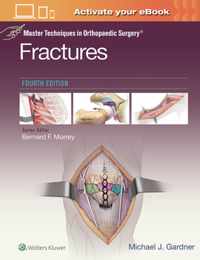 MTOS : FRACTURES 4E CB