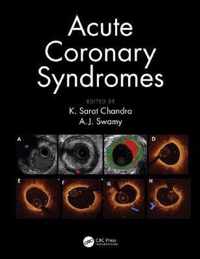 Acute Coronary Syndromes