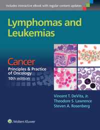 Lymphomas and Leukemias: Cancer