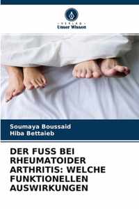 Der Fuss Bei Rheumatoider Arthritis