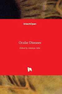 Ocular Diseases