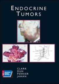 Endocrine Tumors