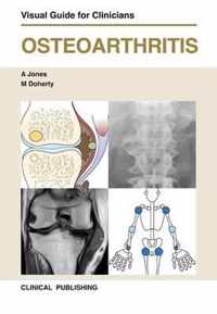 Osteoarthritis