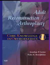 Core Knowledge in Orthopaedics: Adult Reconstruction and Arthroplasty