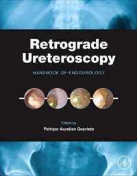 Retrograde Ureteroscopy