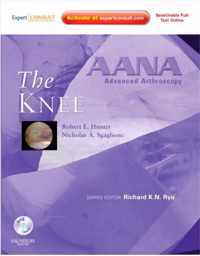 AANA Advanced Arthroscopy: The Knee