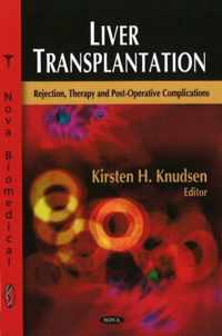 Liver Transplantation