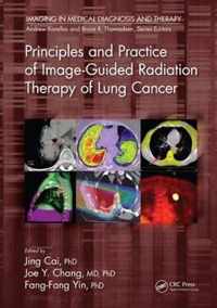 Principles and Practice of Image-Guided Radiation Therapy of Lung Cancer