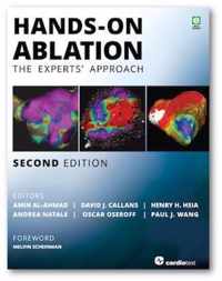 Hands-On Ablation