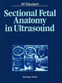 Sectional Fetal Anatomy in Ultrasound