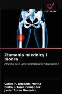 Zlamania miednicy i biodra