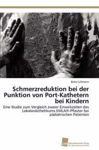 Schmerzreduktion bei der Punktion von Port-Kathetern bei Kindern