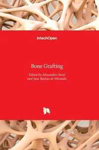 Bone Grafting