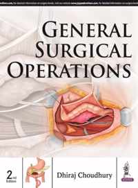 General Surgical Operations