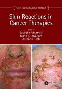 Dermatologic Reactions to Cancer Therapies