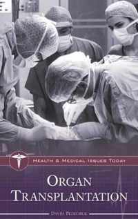 Organ Transplantation