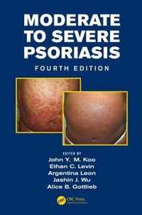 Moderate to Severe Psoriasis