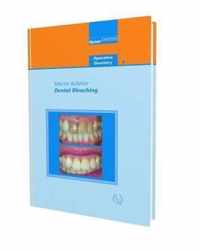 Dental Bleaching