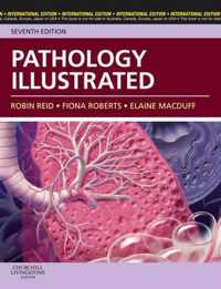 Pathology Illustrated