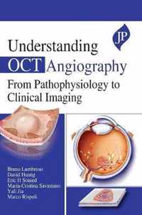 Understanding OCT Angiography