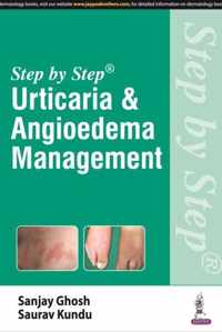 Urticaria & Angioedema