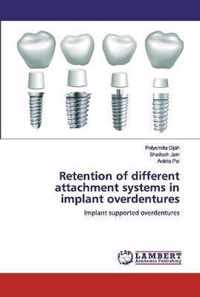 Retention of different attachment systems in implant overdentures