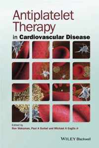 Antiplatelet Therapy in Cardiovascular Disease