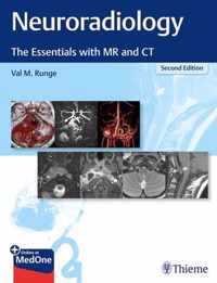 Neuroradiology