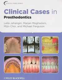 Clinical Cases In Prosthodontics