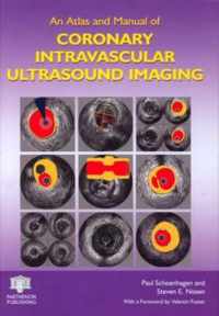 An Atlas and Manual of Coronary Intravascular Ultrasound Imaging