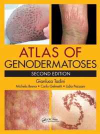 Atlas of Genodermatoses