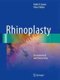 Rhinoplasty